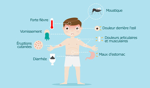 Dengue : tout savoir sur cette maladie